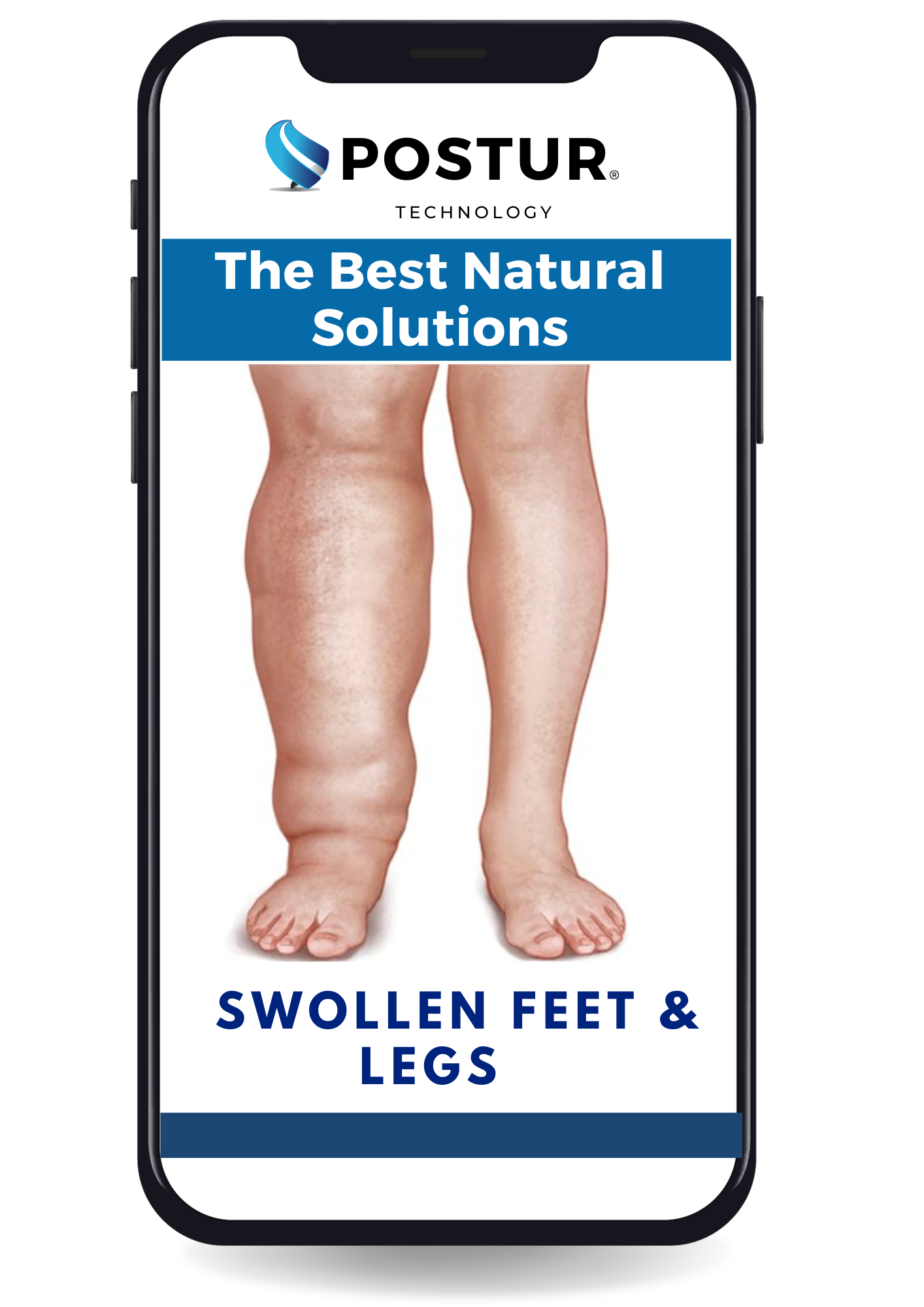 Receive Our eBook: Swollen Feet & Legs - The Best Natural Solutions