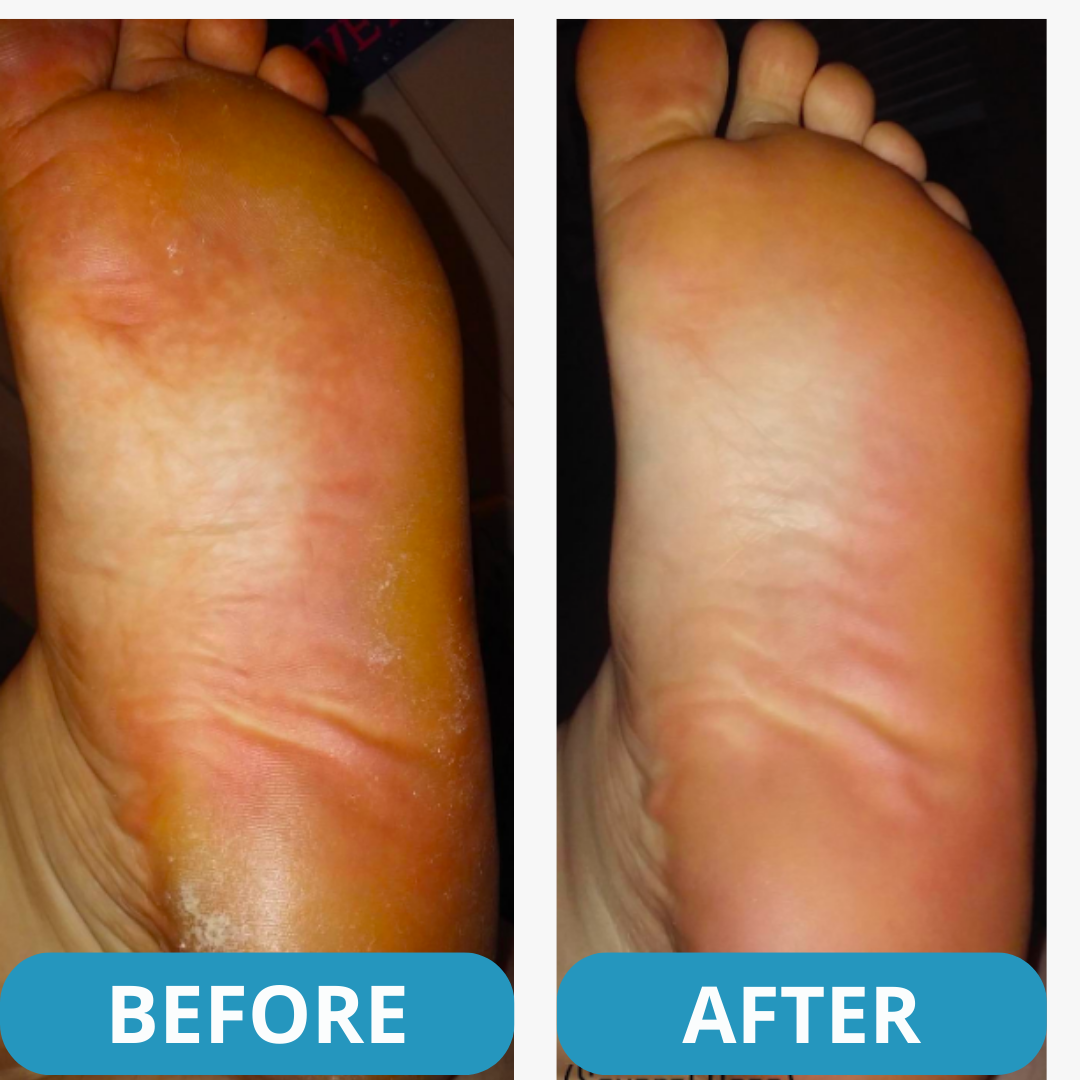 Orthopedic sneakers