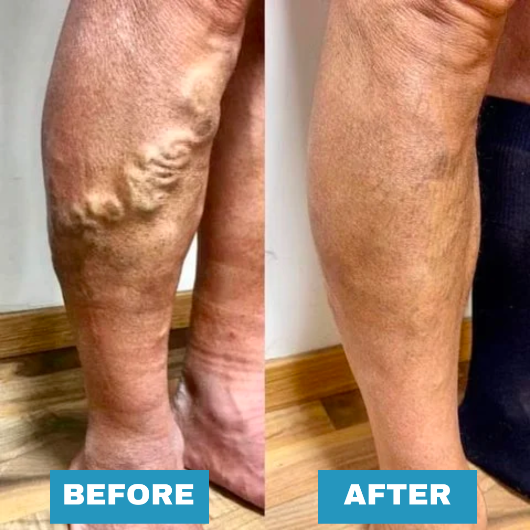 Detoxing Foot Patch