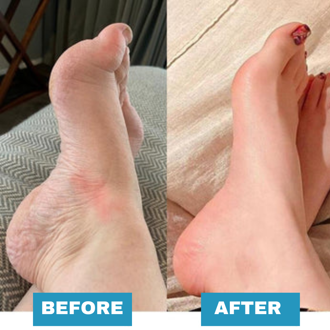 EMS Foot Massager Postur US EMS Foot Massager Postur US