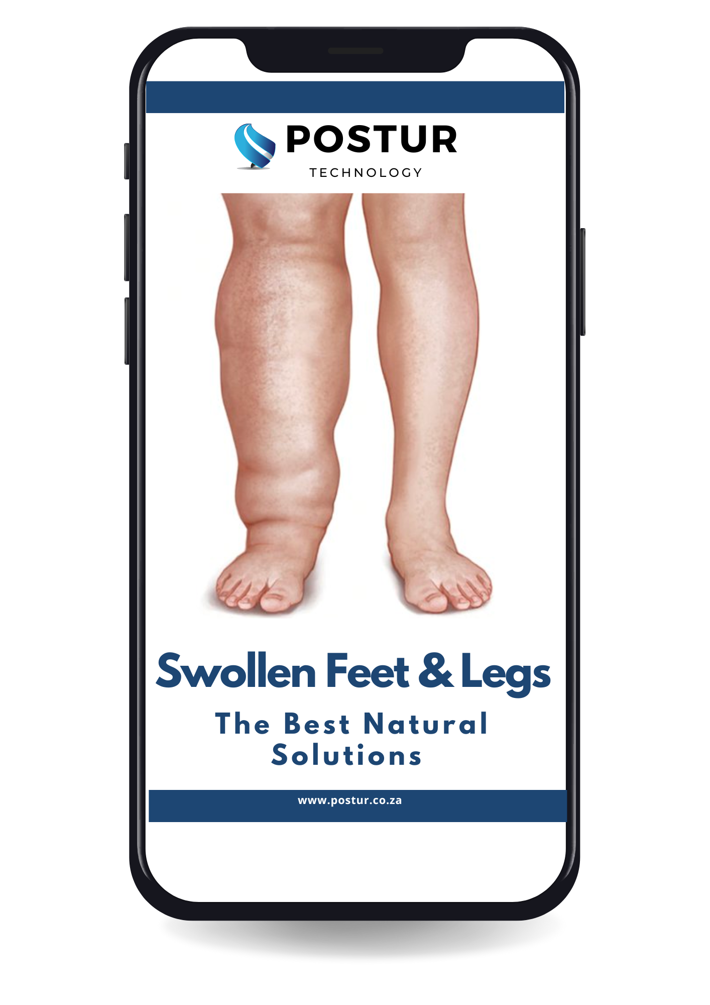 Receive  Our eBook: Swollen Feet & Legs - The Best Natural Solutions