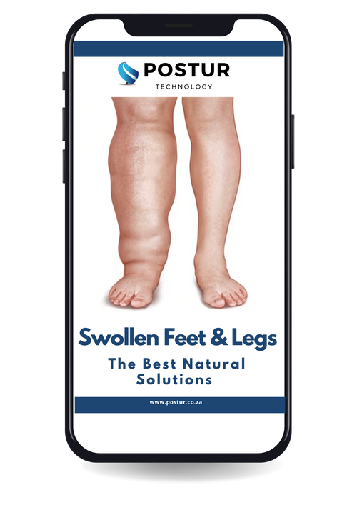 FREE EBOOK I Swollen Feet & Legs - The Best Natural Solutions