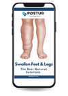 FREE EBOOK I Swollen Feet & Legs - The Best Natural Solutions